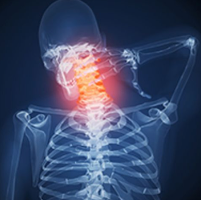 figure image