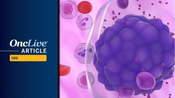 Cevostamab Plus Pomalidomide/Dexamethasone in BCMA-Naive Myeloma | Image Credit: © LASZLO - stock.adobe.com