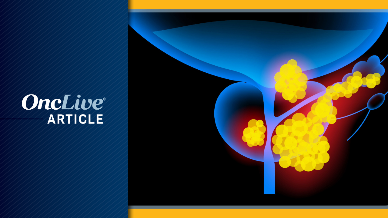 Prostate Cancer | Image Credit: pikovit - stock.adobe.com