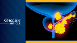 Personalization Drives Next Wave of Metastatic Castration-Sensitive Prostate Cancer Treatment