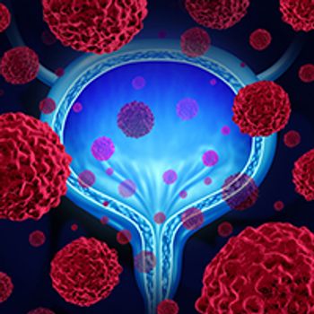 Perioperative Durvalumab Plus SOC in MIUC | Image Credit: © freshidea - stock.adobe.com