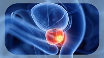 Prostate cancer | Image Credit: Sebastian Kaulitzki © stock.adobe.com