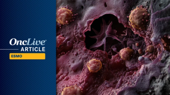 Neoadjuvant Nivolumab/Ipilimumab in Resectable Melanoma | Image Credit: © Cyber Shutter - stock.adobe.com