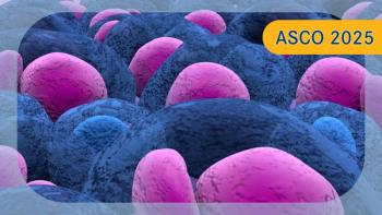 ASCT Plus Isa-KRd Consolidation in Myeloma | Image Credit: © LASZLO - stock.adobe.com
