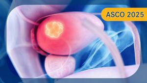 NMIBC | Image credit: © Sebastian Kaulitzki - stock.adobe.com