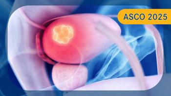 Upper Tract Urothelial Cancer | Image credit:   © Sebastian Kaulitzki - stock.adobe.com