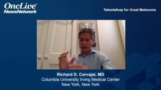 Tebentafusp for Uveal Melanoma