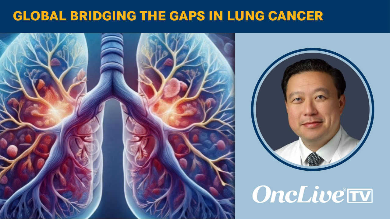 Global Bridging the Gaps in Lung Cancer | Image Credit: © Ashling Wahner & MJH Life Sciences Using AI