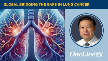 Global Bridging the Gaps in Lung Cancer | Image Credit: © Ashling Wahner & MJH Life Sciences Using AI