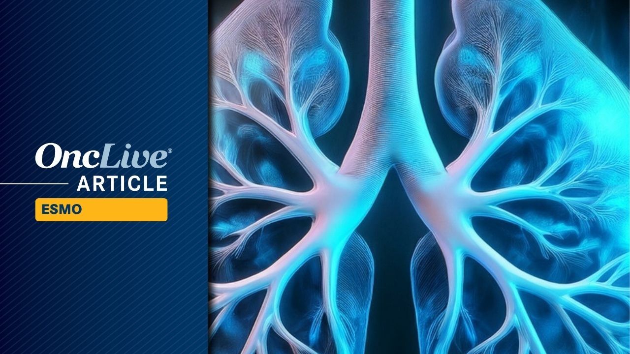 ALK+ NSCLC | Image Credit: © Ashling Wahner & MJH Life Sciences Using AI