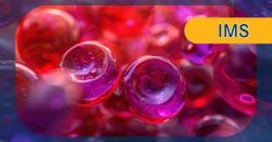 Iberdomide/Daratumumab/Dexamethasone Is Effective in Newly Diagnosed Multiple Myeloma