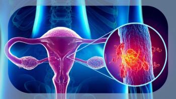 Adjuvant Chemoradiotherapy in High-Risk Endometrial Cancer | Image Credit: © phetchara - stock.adobe.com