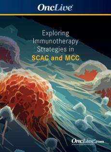 Exploring Immunotherapy Strategies in SCAC and MCC