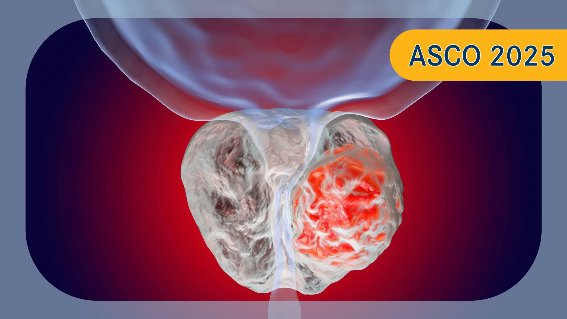 CRPC | Image credit:   © Dr_Microbe - stock.adobe.com