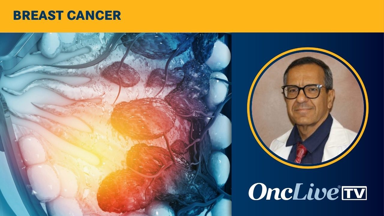 Recurrence Risk Assessment in HR+ Breast Cancer | Image Credit: © Rasi - stock.adobe.com