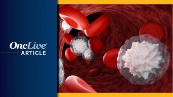 Myelofibrosis | Image Credit: © Om.Nom.Nom - stock.adobe.com