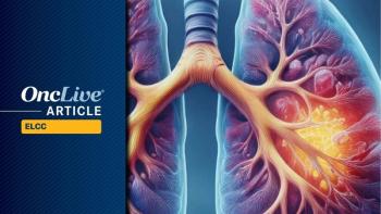 Cemiplimab Plus Chemo in Molecularly Defined Subsets of NSCLC | Image Credit: © Ashling Wahner & MJH Life Sciences Using AI