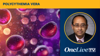 Prithviraj Bose, MD, discusses the ongoing investigation of sapablursen in polycythemia vera.