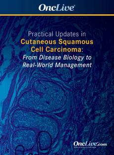 Practical Updates in Cutaneous Squamous Cell Carcinoma: From Disease Biology to Real-World Management