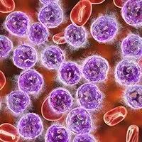 European Commission Grants Orphan Drug Designation to NXC-201 for AL Amyloidosis - Vimarsana News