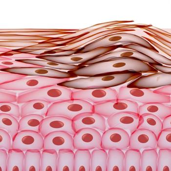 non–small cell lung cancer