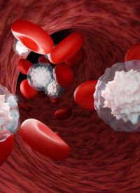 Relapsed/Refractory LBCL | Image credit:   © Om.Nom.Nom - stock.adobe.com