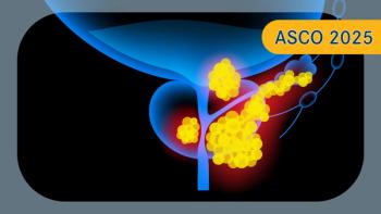 Niraparib/Abiraterone in HRR+ Metastatic Castration-Sensitive Prostate Cancer | Image Credit: © pikovit - stock.adobe.com