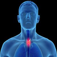 Lenvatinib/Pembrolizumab/Chemo in mESCC | Image Credit: © Lars Neumann - stock.adobe.com