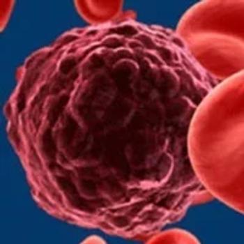 TP53 Mutations Among Prognostic Factors Associated With Ibrutinib-Resistant CLL