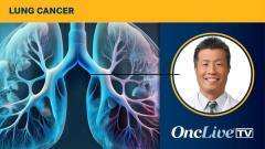 Proton Therapy for Advanced NSCLC | Image by Ashling Wahner & MJH Life Sciences Using AI