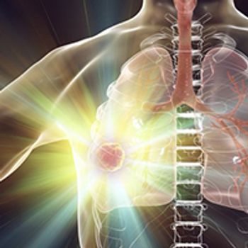 Non–Small Cell Lung Cancer