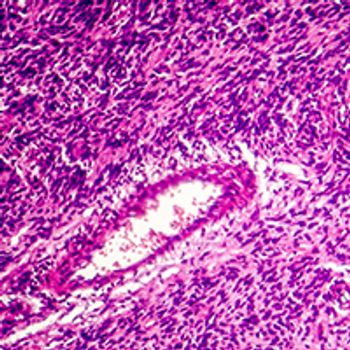 Milademetan in Liposarcoma: © Dr_Microbe - stock.adobe.com
