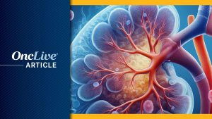 Nivolumab in Advanced RCC:   ©Image by Ashling Wahner & MJH Life Sciences Using AI
