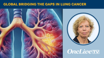 Global Bridging the Gaps in Lung Cancer | Image Credit: © Ashling Wahner & MJH Life Sciences Using AI