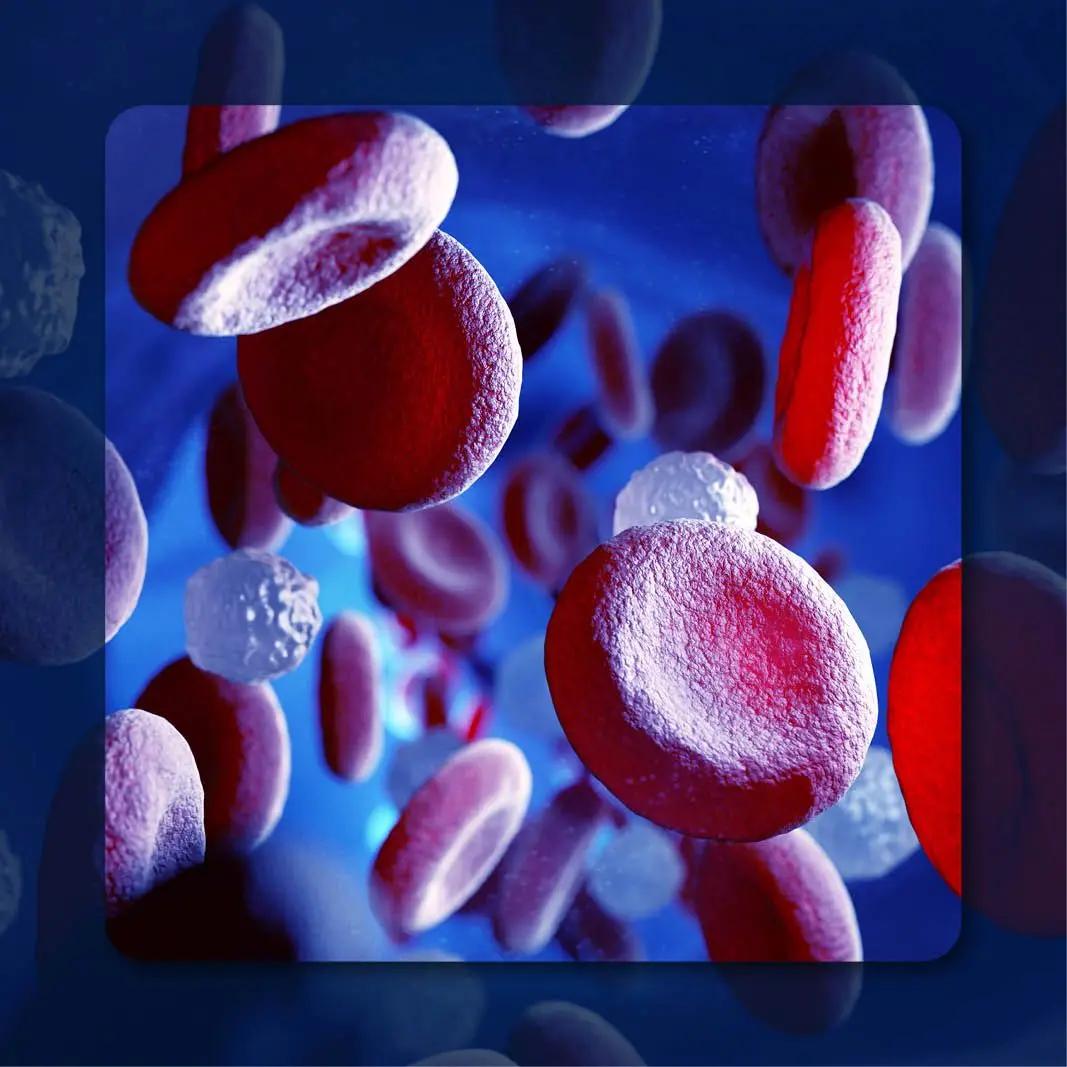 Polycythemia Vera | Image Credit: © Tatiana Shepeleva – stock.adobe.com