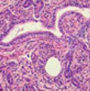 Hepatocellular Carcinoma Surveillance in Focus