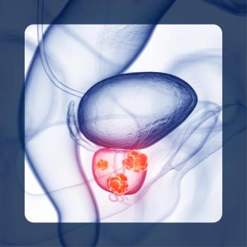 TMPRSS2-ERG in mCRPC | Image Credit: © 