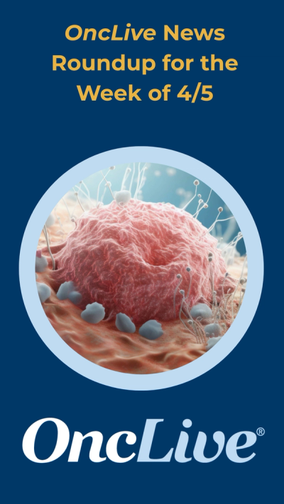 OncLive News Roundup for the Week of 4/5