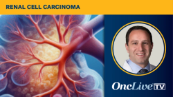 Dr Sweis on the Mechanism of Action of XmAb819 in RCC