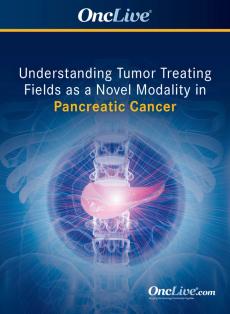 Understanding Tumor Treating Fields as a Novel Modality in Pancreatic Cancer