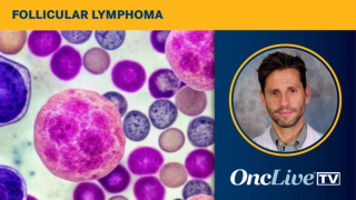Daniel Morillo, MD, discusses the mechanism of action of golcadomide as a potential treatment for relapsed/refractory follicular lymphoma.