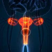 Ovarian Cancer |  Image Credit:  © magicmine - stock.adobe.com