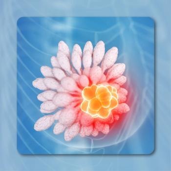 Breast Cancer | stock.adobe.com