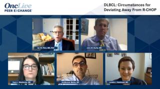 DLBCL: Circumstances for Deviating Away From R-CHOP