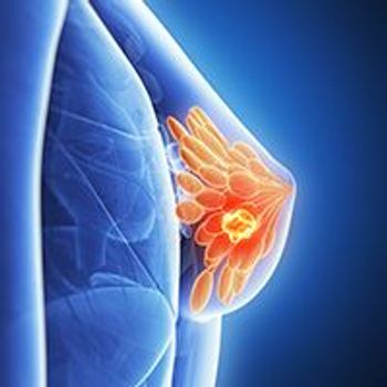 Breast Cancer | stock.adobe.com