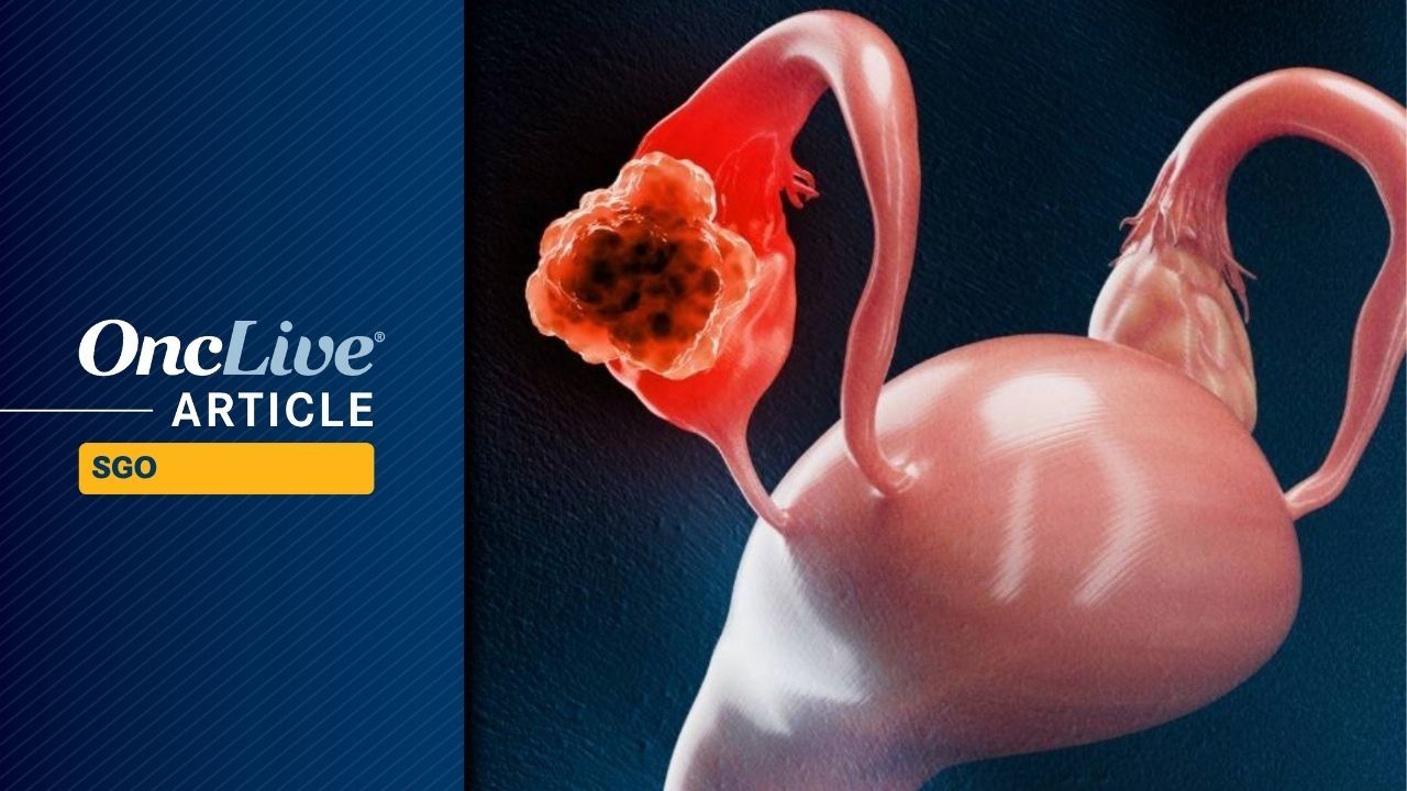 <![CDATA[Abemaciclib Plus Letrozole  Displays Durable Activity in Advanced/Recurrent Endometrioid Endometrial Carcinoma]]>