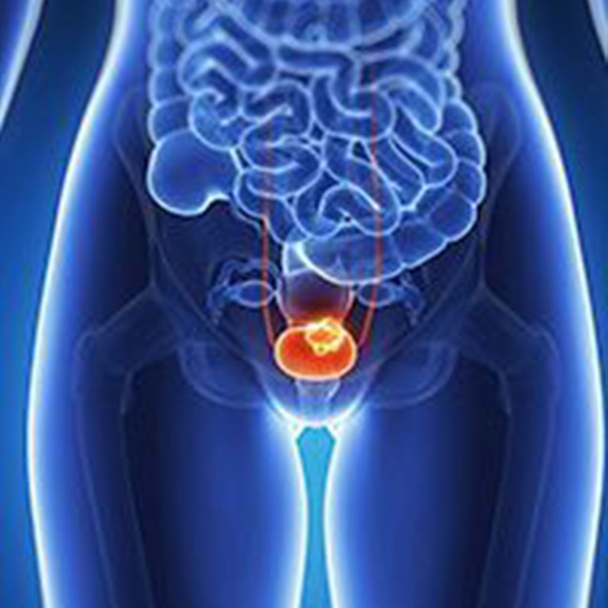 Urothelial Cancer | Image   Credit: © SEBASTIAN KAULITZKI - stock.adobe.com