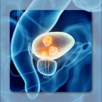Bladder Cancer | Image Credit: © Sebastian Kaulitzki – stock.adobe.com