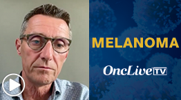 Axel Hauschild, MD, PhD, head, Skin Cancer Trial Center, University Hospital Schleswig-Holstein