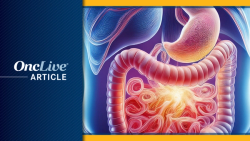 ONO-4578 Plus Nivolumab/Chemo Improves PFS in HER2– Advanced Gastric Cancer